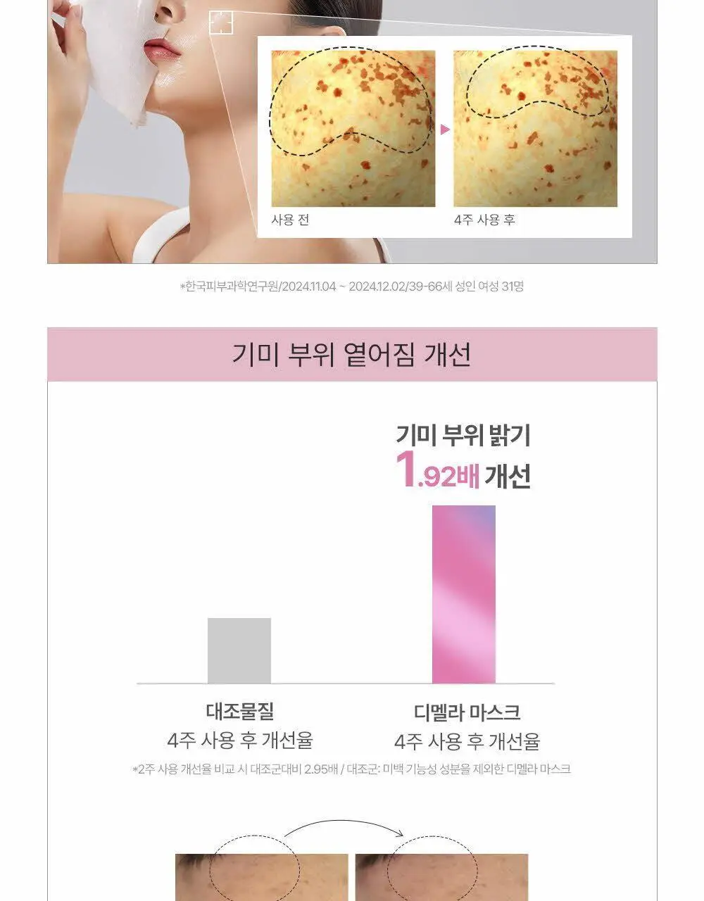 [한정기획] 피지오겔 사이언수티컬즈 디멜라나이저 토닝 앰플 세럼 마스크 3+1매 상세페이지 9